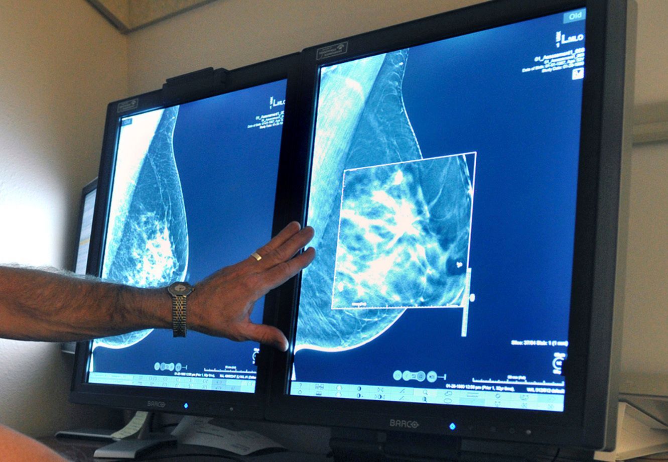 Regelbunden mammografi lika viktigt som att känna på brösten