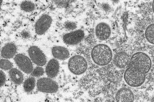 Apkoppor orsakas av ett poxvirus
